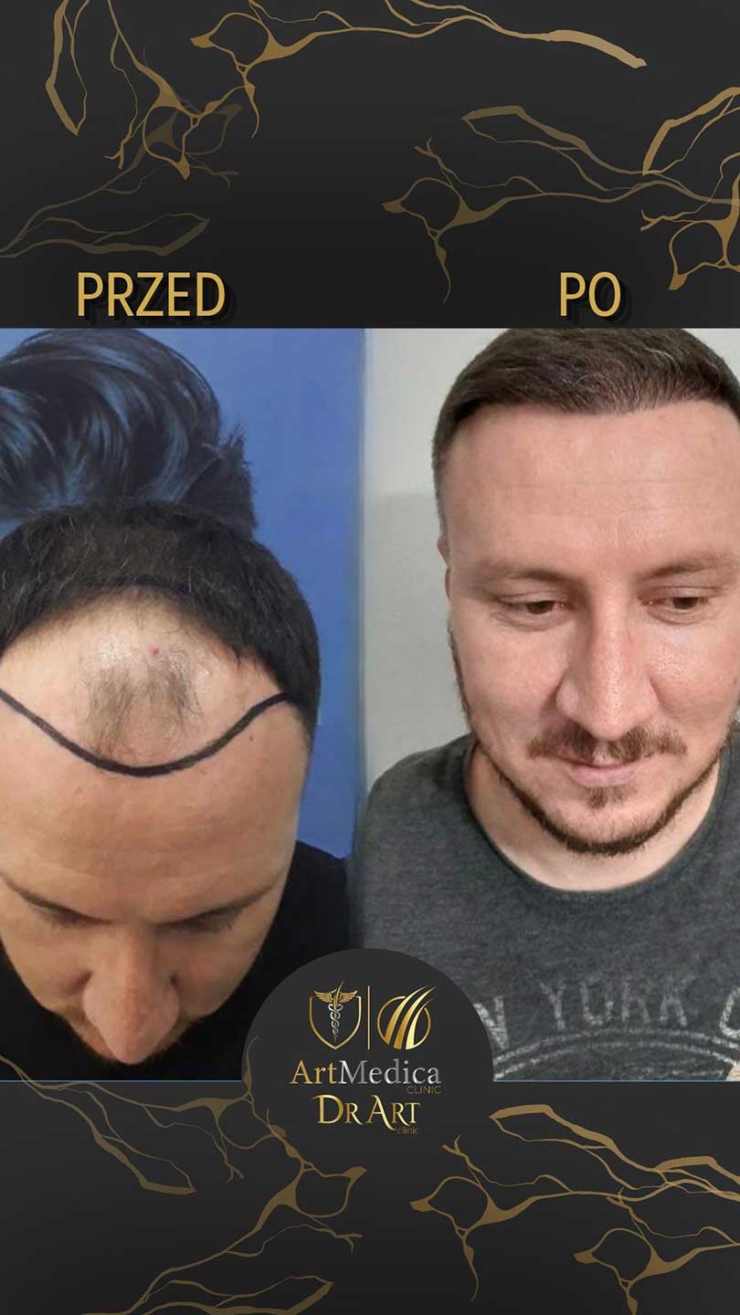 Metamorfoza pacjenta - przed i po