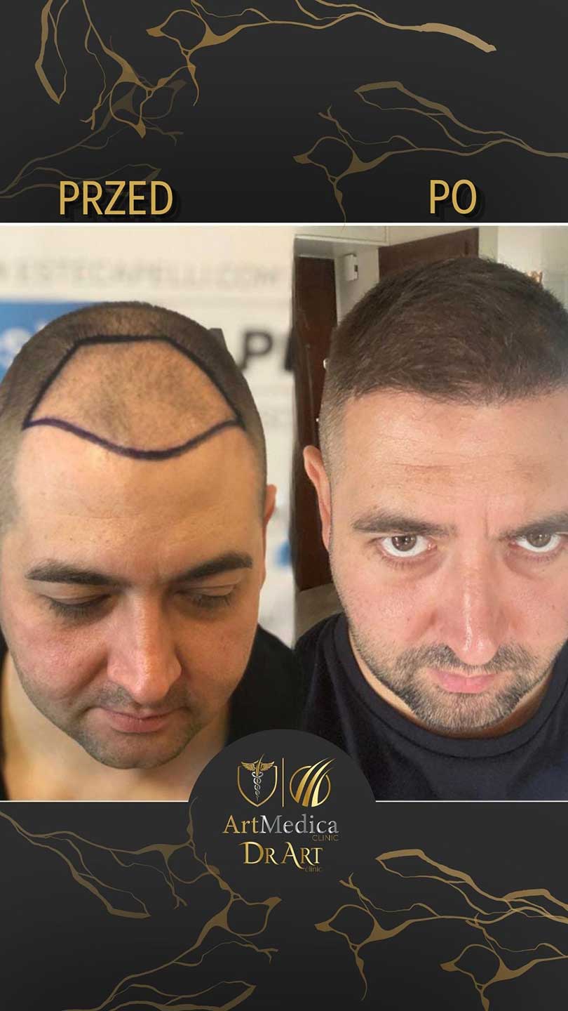 Metamorfoza pacjenta - przed i po